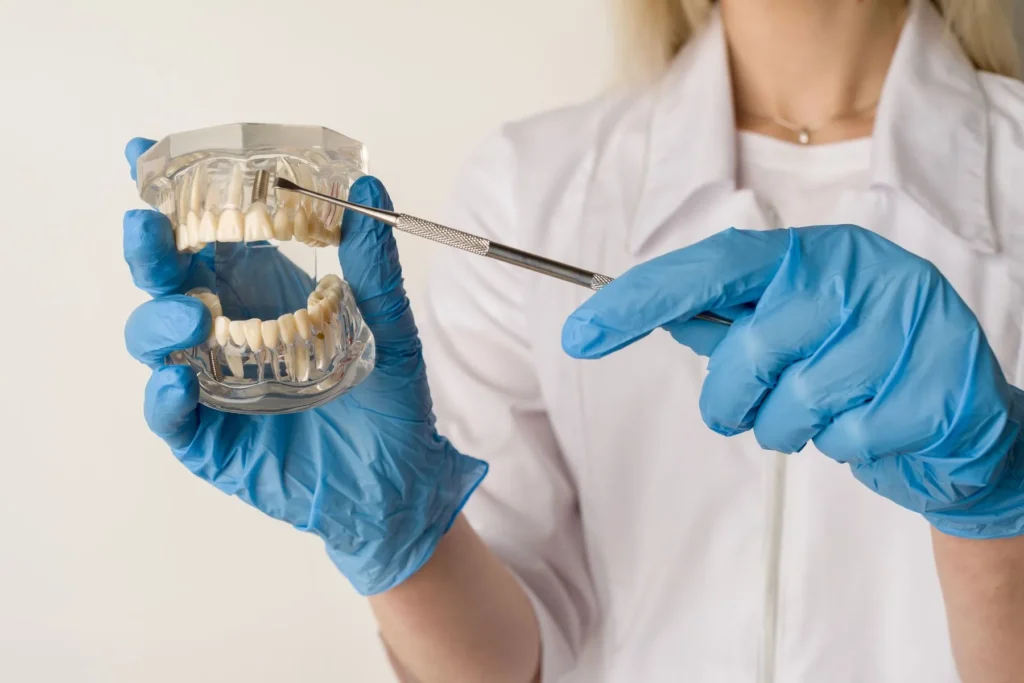 quanto costa un impianto dentale