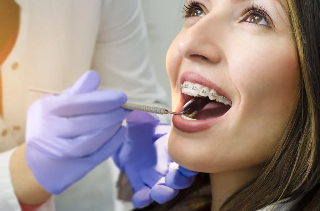 Apparecchio dentale a Roma Montesacro